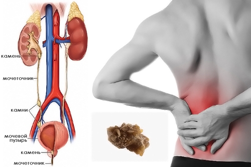 ������ ������� ������������ ������� ��� �������������� �������������