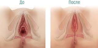 ������������� �������� ������� ������� � ������ � ������