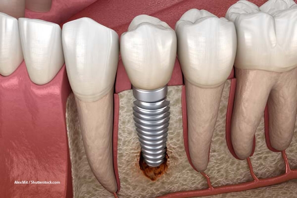 �������� � ������������ ������ �����������