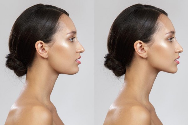 ��� ������ ���������� �� ������� ����������